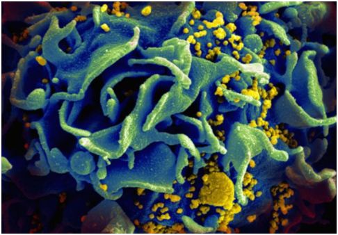 17c啊啊啊啊开发出靶向HIV病毒库的Dual-CAR-T细胞,为治愈HIV感染奠定基础